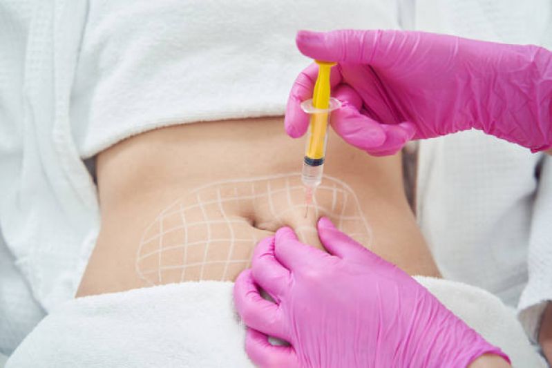 Intradermoterapia