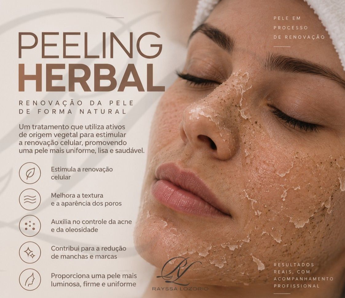 Peeling Herbal