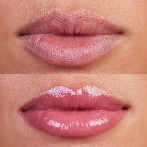 Hidra Gloss Labial